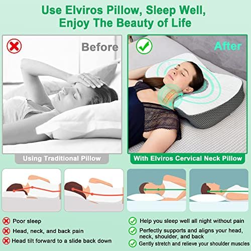 Elviros Cervical Memory Foam Neck Pillow for Pain Relief Side Sleeping - Image 6